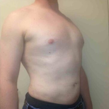 A shirtless person stands sideways against a plain background, showing their chest and abdomen.