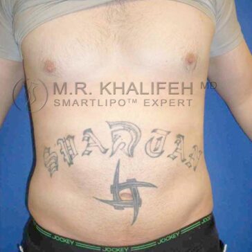 A person with the word "SPARTAN" and a large black tattoo design on their lower abdomen.