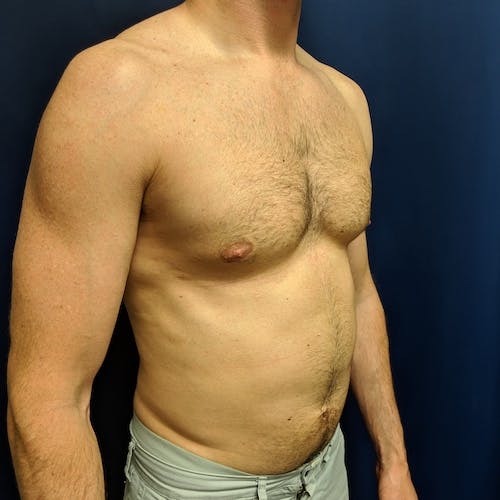 Shirtless adult male standing against a dark blue background, photographed from the front left side, wearing light gray shorts.