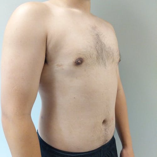 A shirtless person stands against a plain light-colored background, shown from shoulders to waist, facing slightly to the side.