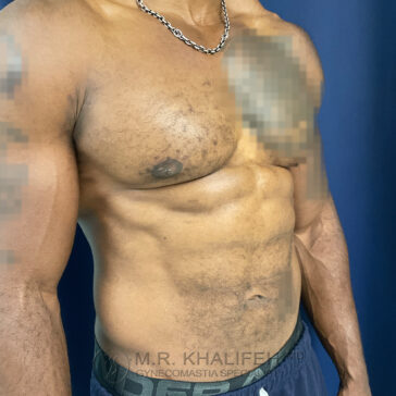 A shirtless man with visible chest and abdominal muscles stands against a blue background; some parts of the chest are blurred for privacy.