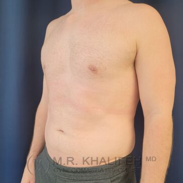 A shirtless man stands against a dark blue background, showing his chest and abdomen with faint red marks around his torso.