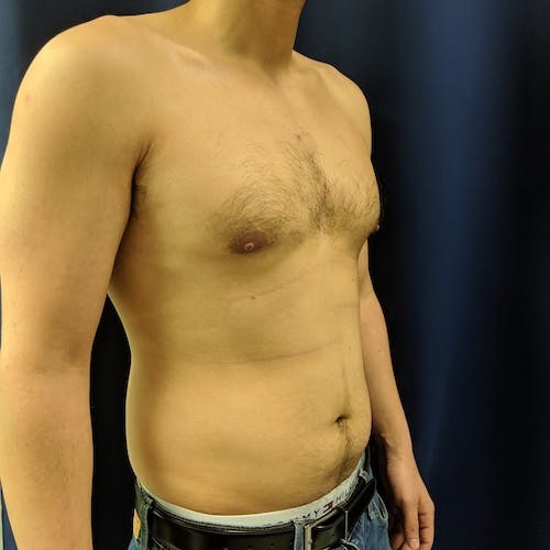 A shirtless person standing at an angle, showing their upper body and abdomen against a dark blue background.