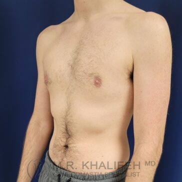 A shirtless person standing against a dark blue background, showing their upper body and torso; their head is not visible.