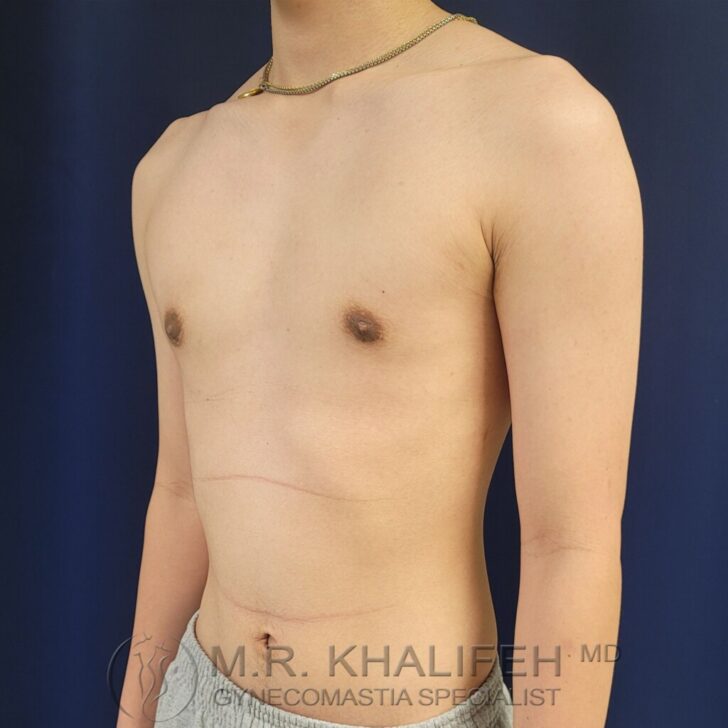 A person with a bare chest and minimal body fat stands against a dark blue background, wearing a necklace and grey shorts.