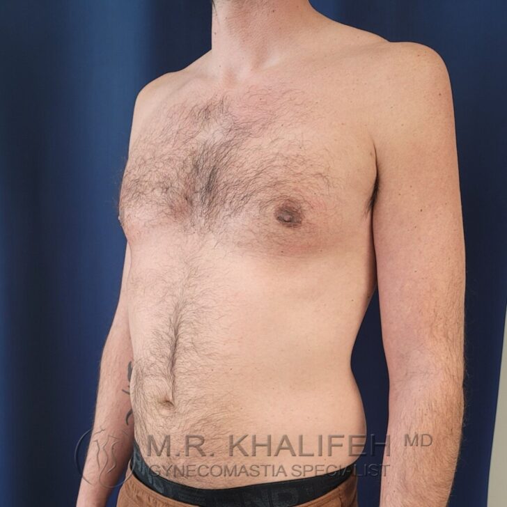 A shirtless person with light skin and chest hair stands against a dark blue background, shown from mid-thigh to shoulders at a three-quarter angle.