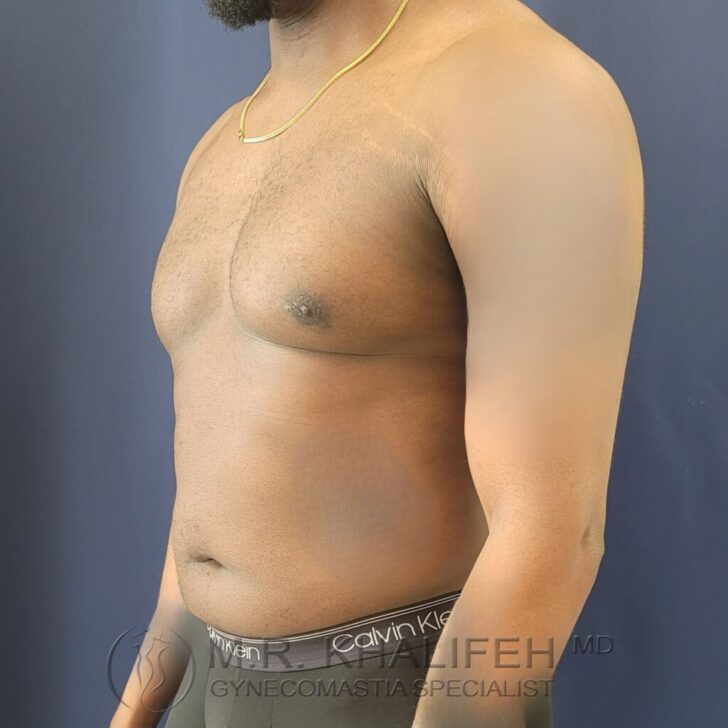 A man with mild gynecomastia stands shirtless in profile against a blue background, wearing a gold necklace and Calvin Klein underwear.
