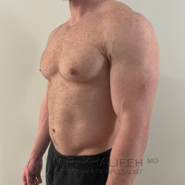Shirtless man standing sideways, showing his upper body and torso against a plain background.