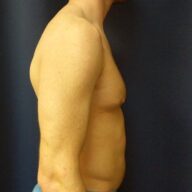 A shirtless man stands sideways against a dark background, showing his upper body and arm.