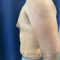 Side view of a shirtless adult male torso against a blue background, showing the chest and upper arm with a visible watermark at the bottom.