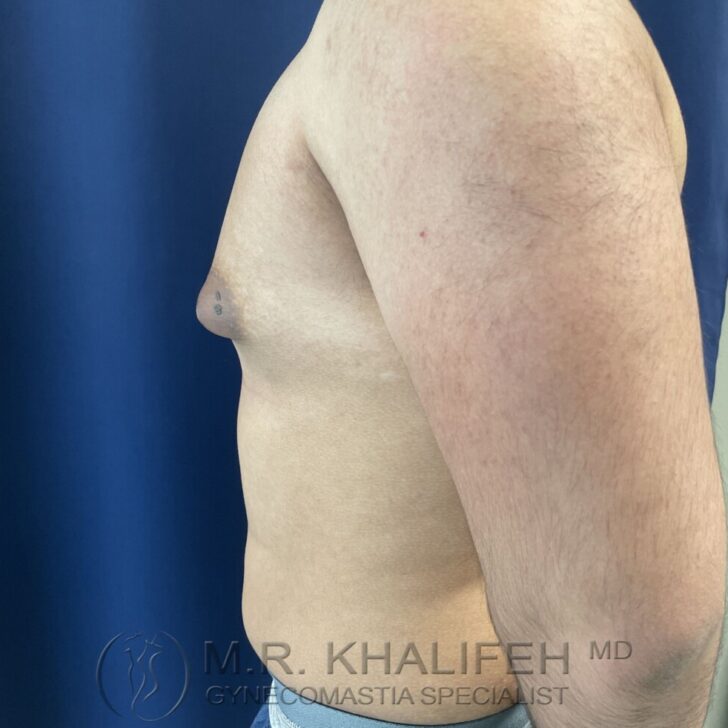 Side view of a shirtless adult male torso against a blue background, showing the chest and upper arm with a visible watermark at the bottom.