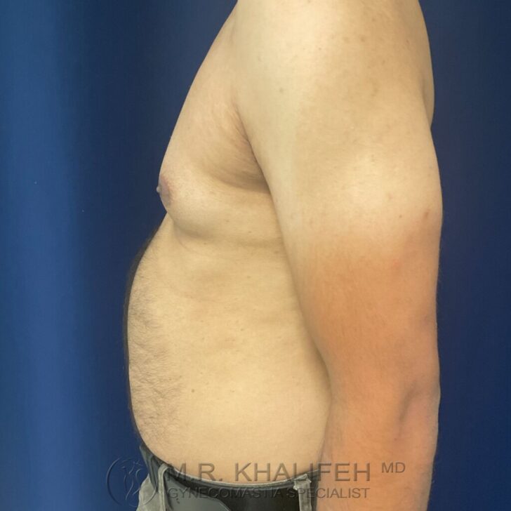 Side view of a shirtless adult male torso against a blue background, showing a protruding chest and abdomen.