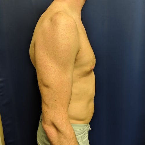 A shirtless man standing in profile against a dark blue background, showing his upper body, arm, and torso.