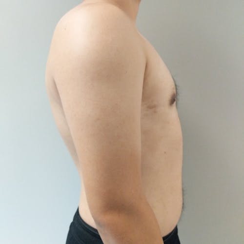 A shirtless person standing sideways against a plain light gray background, showing the upper body and part of the abdomen.