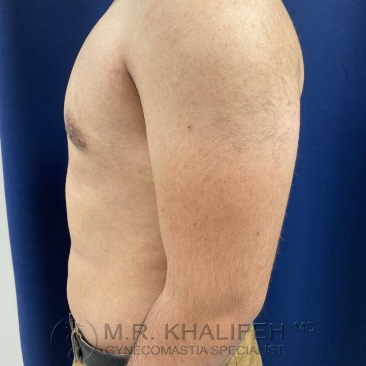 A man’s bare upper torso is shown from the side against a blue background, with the doctor’s watermark at the bottom of the image.
