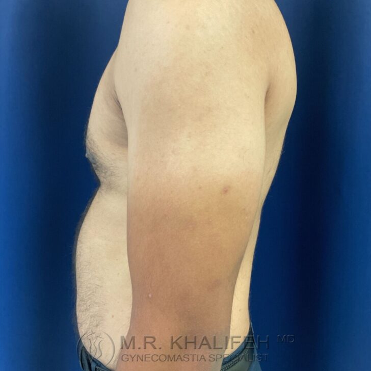 Side view of a shirtless adult male torso and arm against a blue background. The image shows the chest and upper abdomen.
