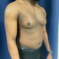 A man with visible gynecomastia stands shirtless against a blue background, wearing black Calvin Klein underwear and a gold necklace.