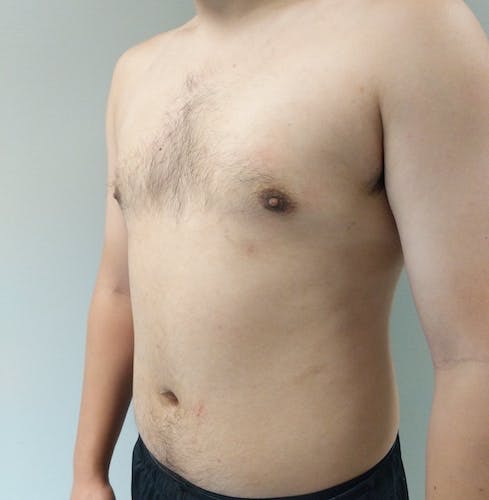 A shirtless person with light skin and short dark hair is shown from the shoulders to the waist, standing against a plain light background.