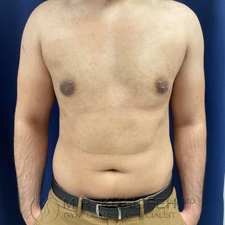 A shirtless person standing against a blue background, showing their chest and abdomen. The person is wearing tan pants with a black belt.