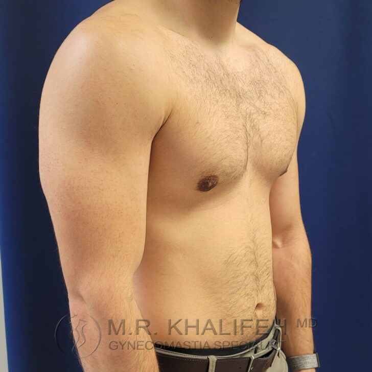 A shirtless man standing against a blue background, showing the upper body and torso from the side.