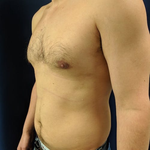 Shirtless person with a visible chest and torso, standing against a dark background, facing partially to the side.