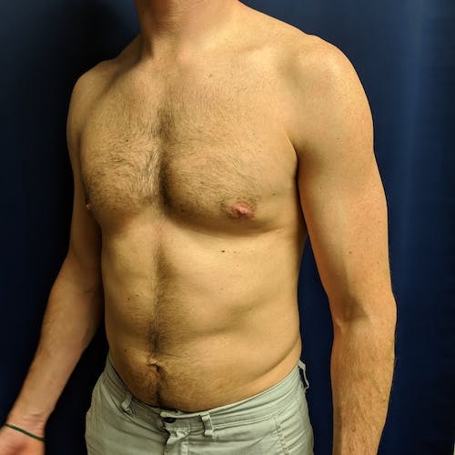 Shirtless man with light skin and short hair stands against a dark blue background, wearing light-colored shorts. His torso and arm muscles are visible.