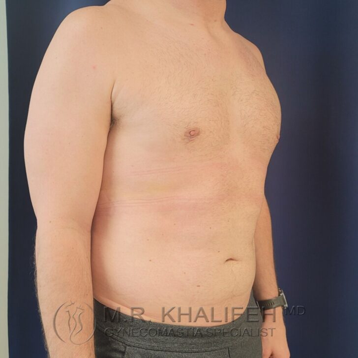 A shirtless adult male shown from the side, standing upright, with visible body hair and slight abdominal protrusion.