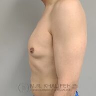 A shirtless male torso is shown from the side against a plain background, with the logo and name "M.R. Khalifeh MD Gynecomastia Specialist" at the bottom.