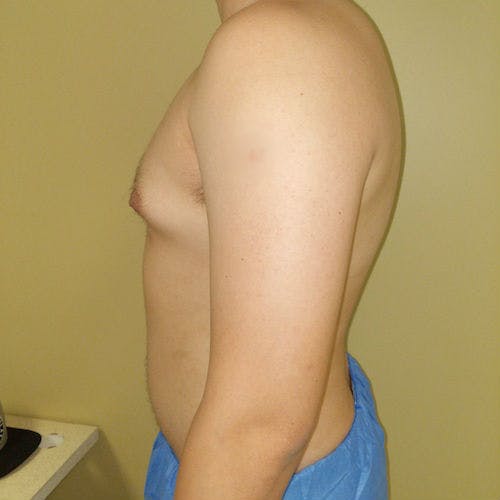 A person standing sideways against a beige wall, shirtless and wearing blue shorts, with visible mild chest and abdominal fat.