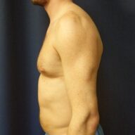 Side view of a shirtless adult male with a slight forward rounding of the upper back, standing against a dark background.