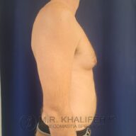 Adult male torso in profile against a dark blue background, shirtless, with visible chest and arm; watermark with text at the bottom.