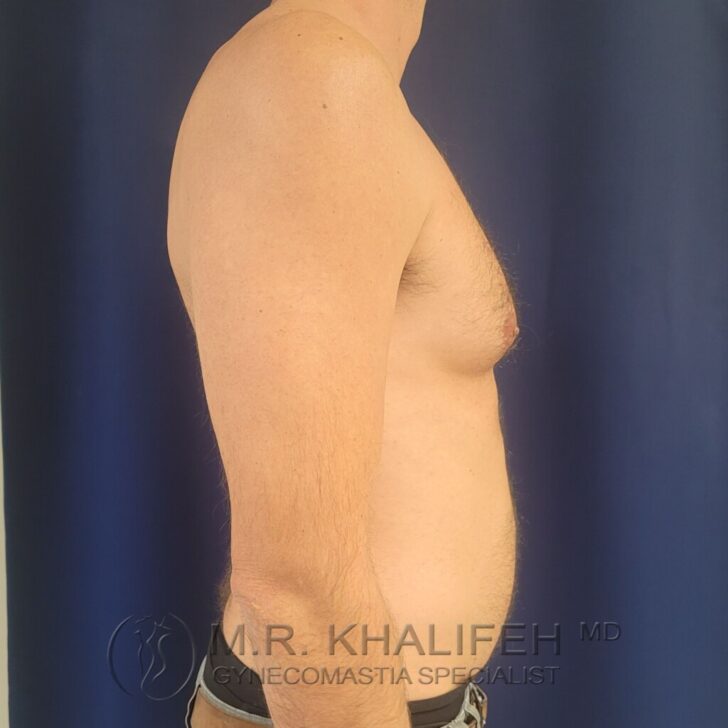Adult male torso in profile against a dark blue background, shirtless, with visible chest and arm; watermark with text at the bottom.
