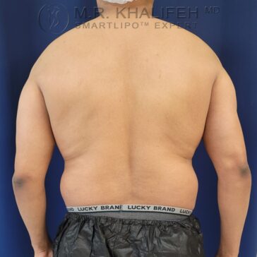 A person stands facing away from the camera, showing their bare back and wearing black drawstring shorts with "Lucky Brand" visible on the waistband.